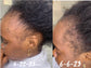 Edge & Temple Recovery Oil