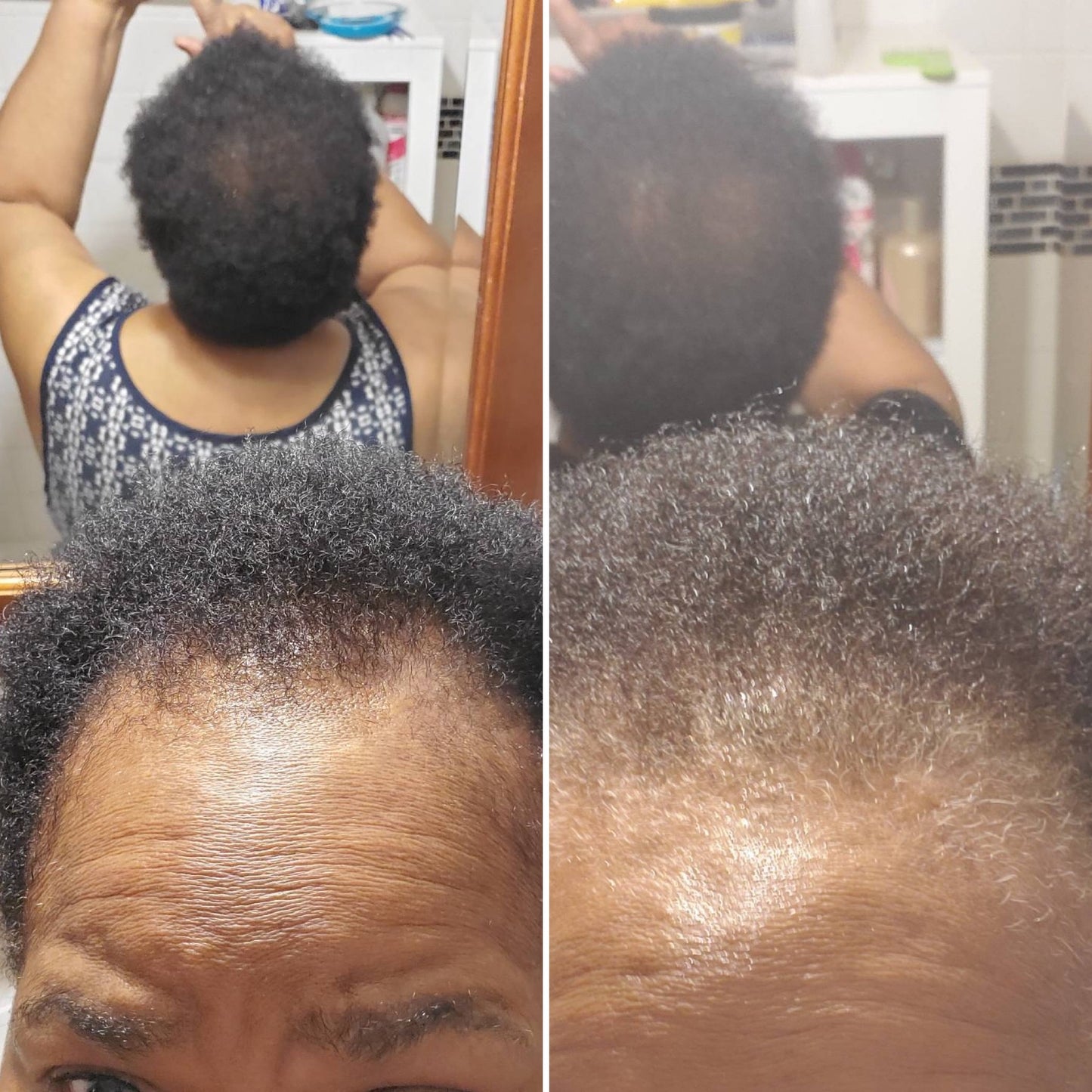 Edge & Temple Recovery Oil