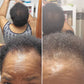 Edge & Temple Recovery Oil