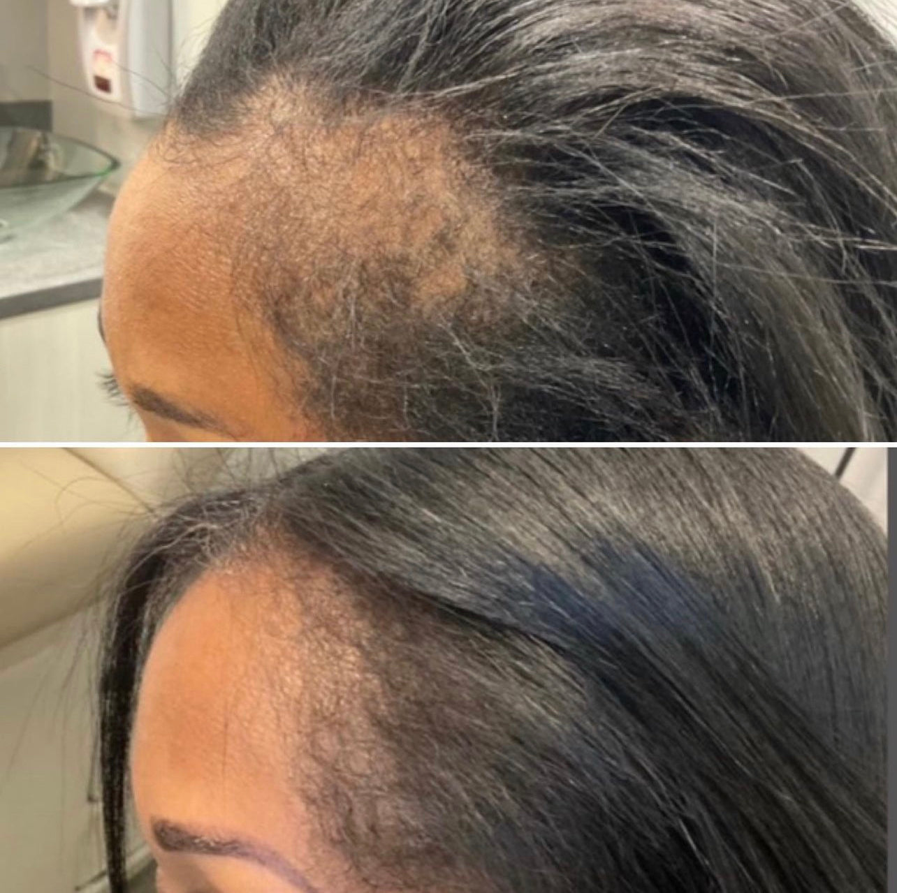 Edge & Temple Recovery Oil