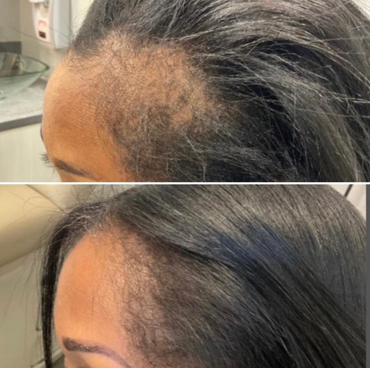 Edge & Temple Recovery Oil